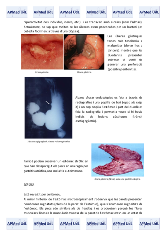 14 (VI). Sistema digestiu.pdf