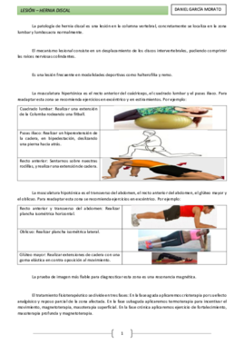 Lesión - Hernia discal.pdf