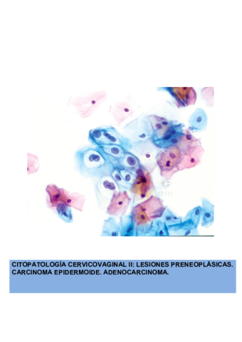 LESIONES-PRENEOPLASICAS-CARCINOMA-EPIDERMOIDE-ADENOCARCINOMA.pdf