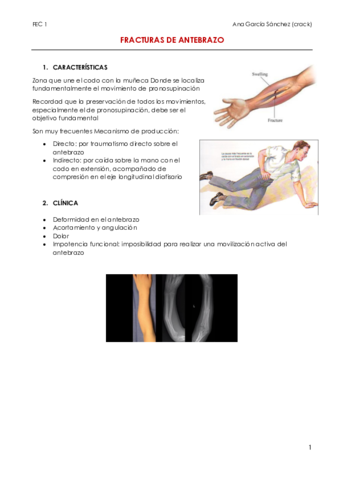 FRACTURAS-DE-ANTEBRAZO.pdf