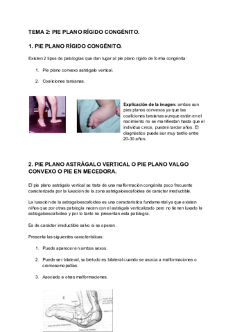 TEMA-2-PIE-PLANO-RIGIDO-CONGENITO-2.pdf