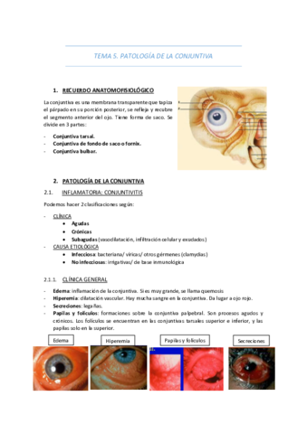 TEMA-5-PATOLOGIA-DE-LA-CONJUNTIVA.pdf