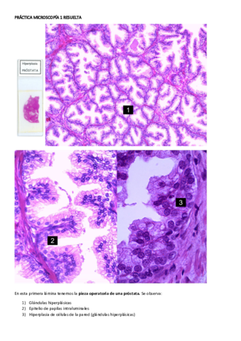 PRACTICA-MICROSCOPIA-1-RESUELTA.pdf