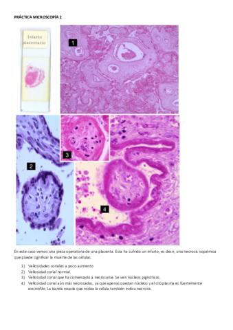 PRACTICA-MICROSCOPIA-2-RESUELTA.pdf