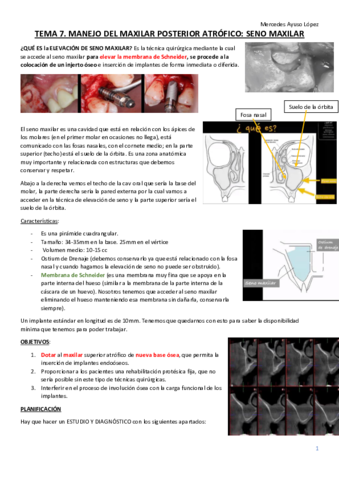 TEMA-7-cirugia-bucal-avanz-e-implant.pdf
