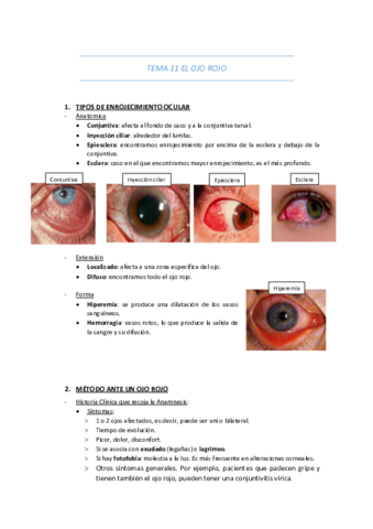 TEMA-11-EL-OJO-ROJO.pdf