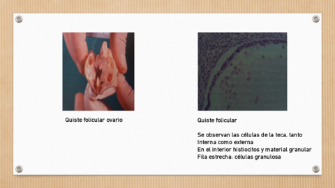 Imagenes-ovario-caracteristicas.pdf