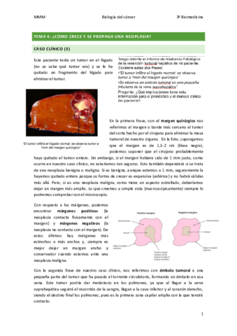TEMA-4-Como-crece-y-se-propaga-una-neoplasia.pdf
