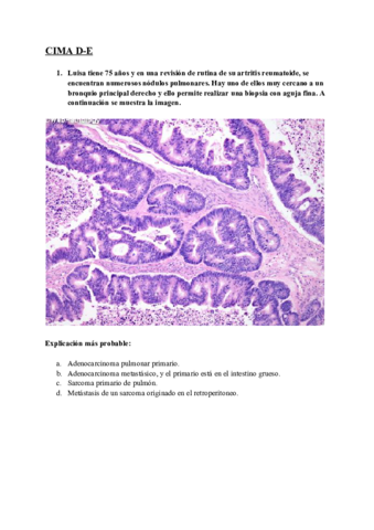 CIMAs-D-E-La-amenaza-de-las-neoplasias.pdf