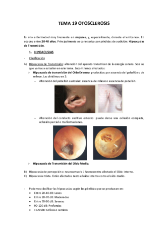 TEMA-19-OTOSCLEROSIS.pdf