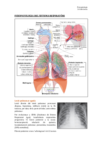 TEMA 3. Fisiopatologia del sistema respiratori.pdf