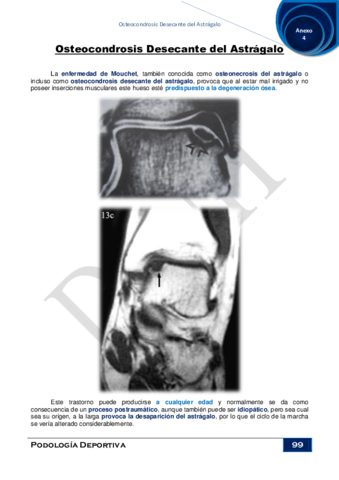 Anexo-4Osteocondrosis-Desecante-del-Astragalo.pdf