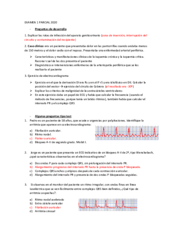 EXAMEN-1-PARCIAL-2020.pdf