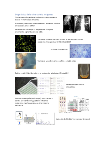 Tuberculosis-imagenes.pdf