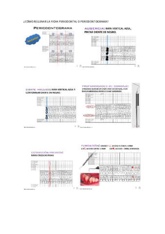 Rellenar-Periodontograma.pdf