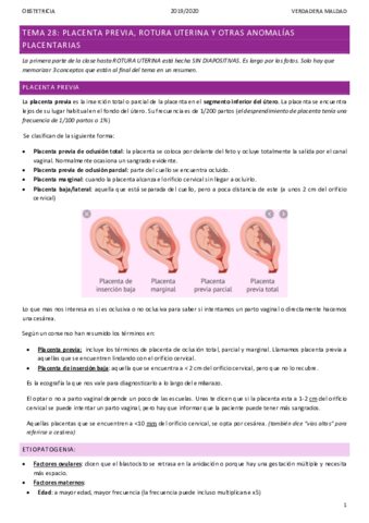 TEMA-28-PLACENTA-PREVIA.pdf