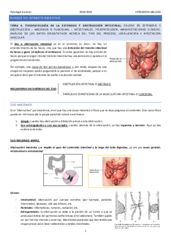 TEMA-6-FISIOPATOLOGIA-DE-LA-OBSTRUCCION-INTESTINAL.pdf