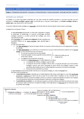 TEMA-1-Sindrome-esofagico.pdf