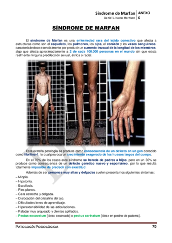 ANEXO-6o-Sindrome-de-Marfan.pdf