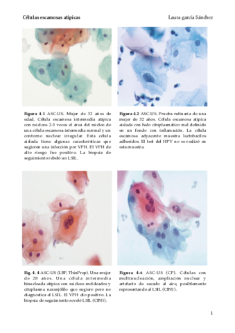 Celulas-escamosas-atipicas.pdf