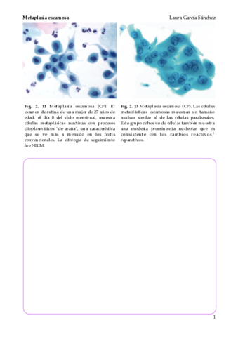 Metaplasia-escamosa.pdf