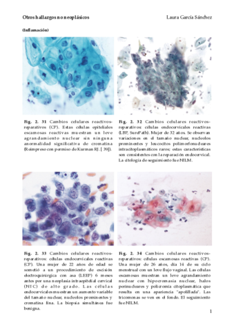 Otros-hallazgos-no-neoplasicos.pdf