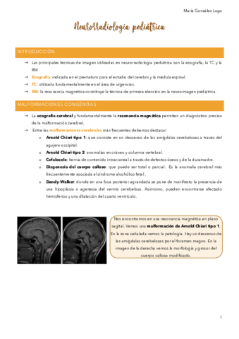 TEMA-11.pdf