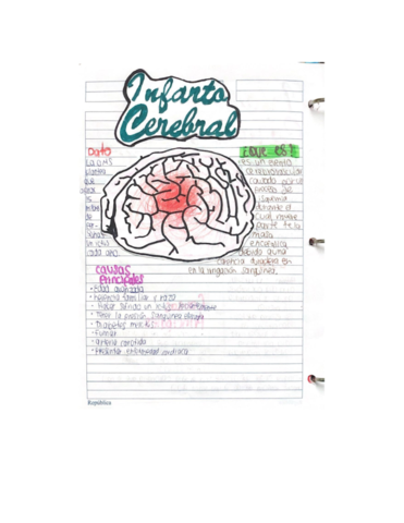 infarto-cerebral.pdf