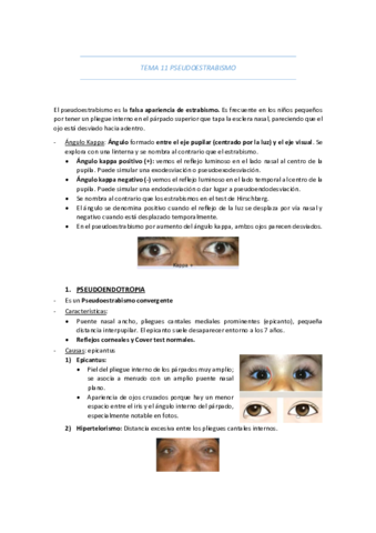 TEMA-11-PSEUDOESTRABISMO.pdf