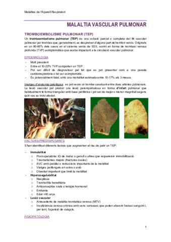 7-MalaltiaVascularPulmonar.pdf