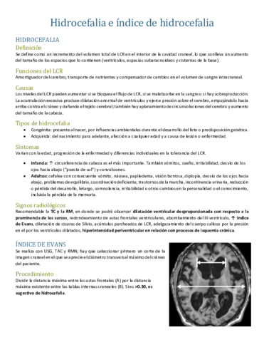 Hidrocefalia-e-indice-de-hidrocefalia.pdf