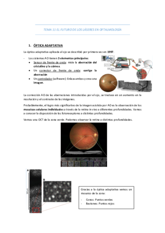 TEMA-11-EL-FUTURO-DE-LOS-LASERES-EN-OFTALMOLOGIA.pdf
