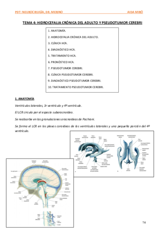 T4-HCA-pseudotumor-cerebri.pdf