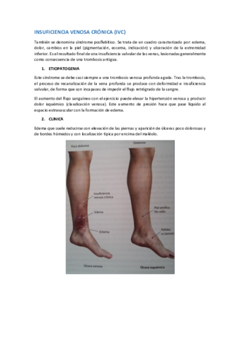 IVC-TVP.pdf