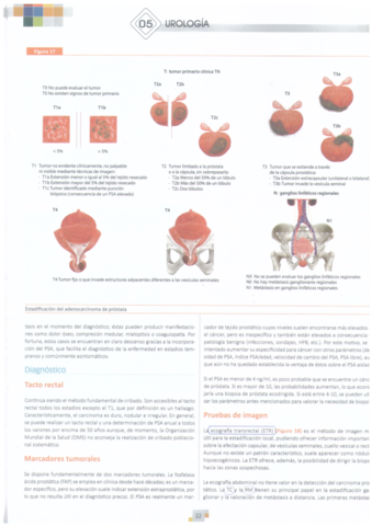 Urologia-Tumor-vesical-Manual-CTO.pdf