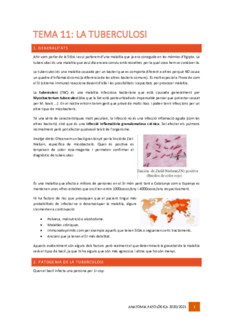 Tema-11-La-Tuberculosi.pdf