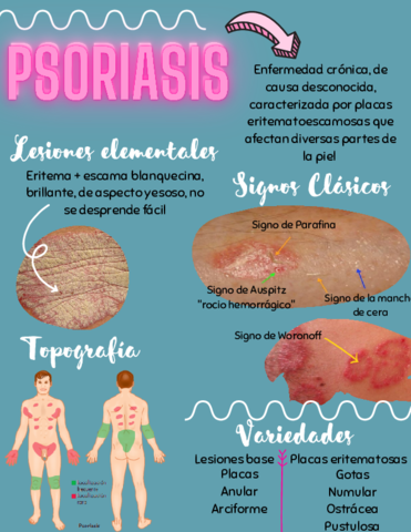 Psoriasis.pdf