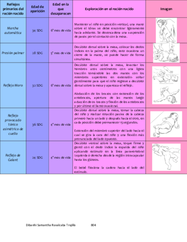 Reflejos-primarios-del-recien-nacido-DSRT.pdf
