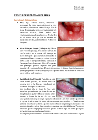 TEMA 5. Fisiopatologia digestiva.pdf