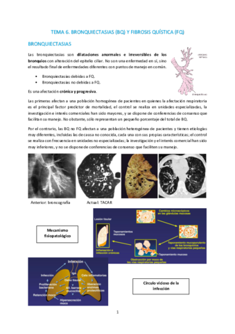 T6-Bronquiectasias-y-fibrosis-quistica.pdf