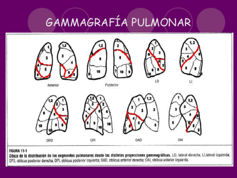 3-Gammagrafia-pulmonar.pdf