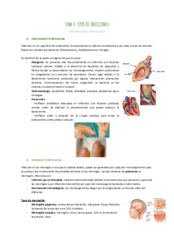TEMA-4-TIPOS-DE-INFECCIONES.pdf