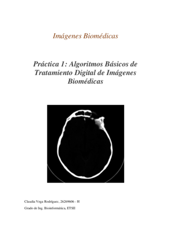 Memoria-Imagenes-Biomedicas-ClaudiaVegaRodriguez.pdf