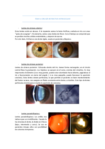 TEMA-4-CIRUGIA-REFRACTIVA-INTRAOCULAR.pdf