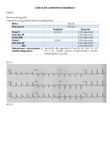 CARDIOPATIA-ISQUEMICA.pdf