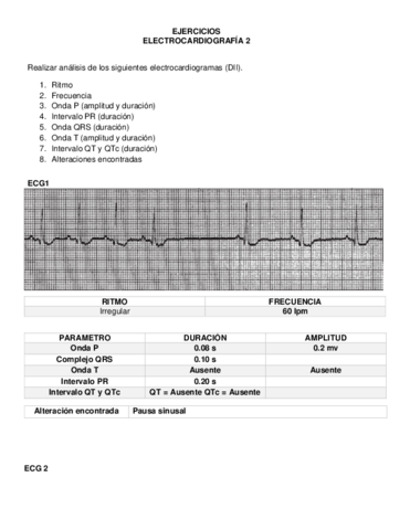 EJERCICIOS-ELECTROCARDIOGRAFIA-2.pdf