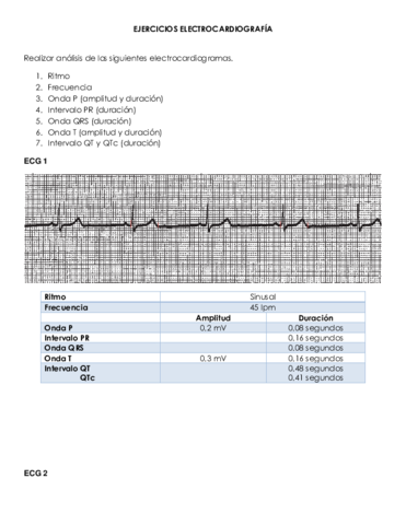 EJERCICIOS-ELECTROCARDIOGRAFIA.pdf