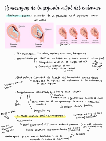 Hemorragias-de-la-2da-mitad-del-embarazo.pdf