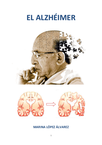 alzheimer.pdf