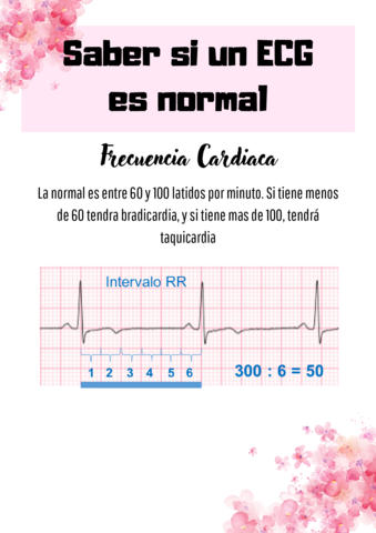 Saber-si-un-ECG-es-normal.pdf